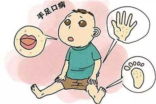 手足口病怎么确诊