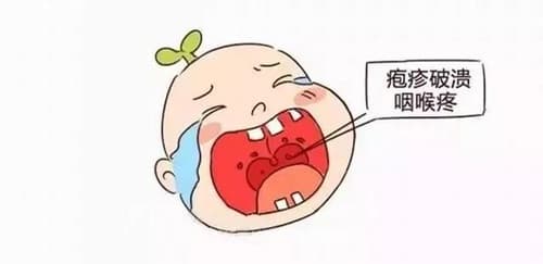手足口病主要传播途径