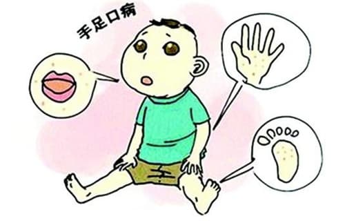 跟手足口病儿童接触了怎么办