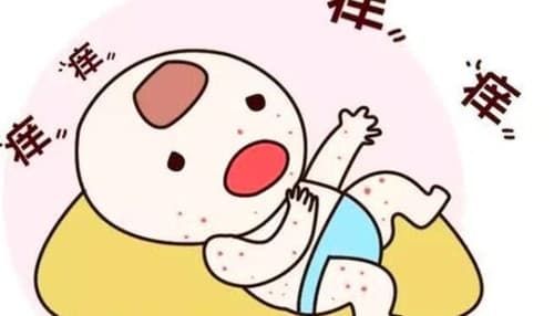 婴儿痱子怎么快速消除